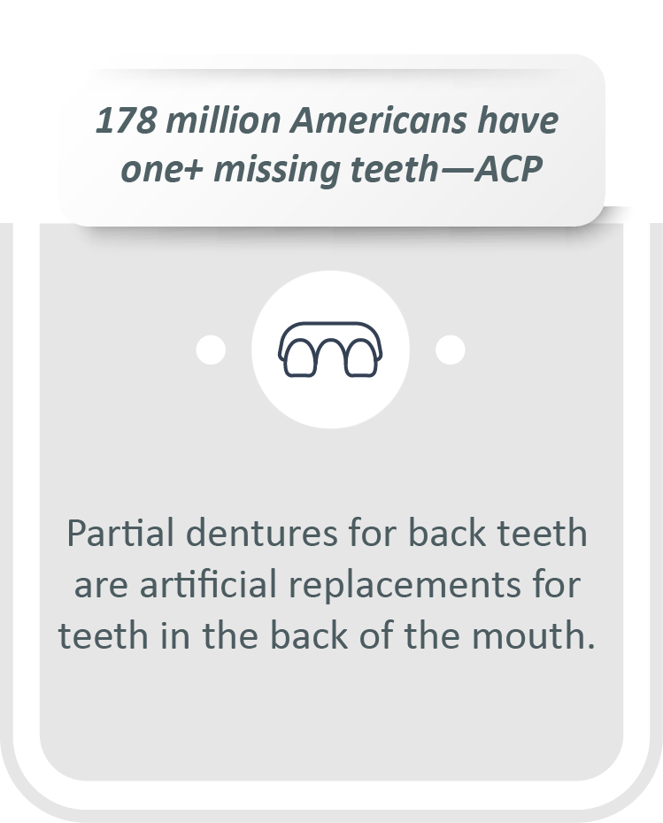 Partial dentures for back teeth infographic: Partial dentures for back teeth are artificial replacements for teeth in the back of the mouth.