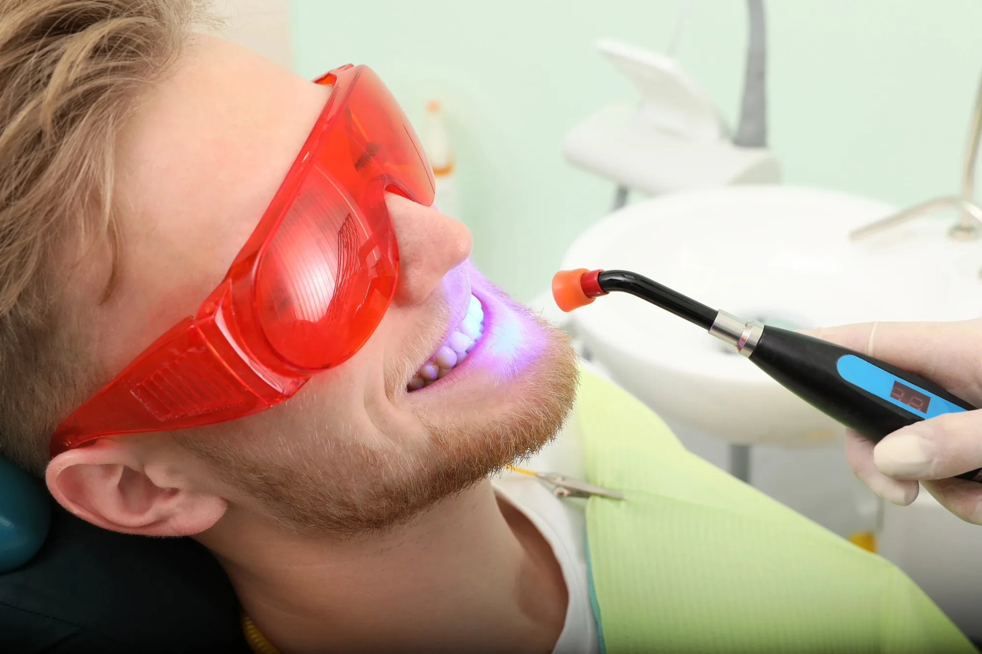 teeth-whitening-arlington-va-advanced-whitening-procedure