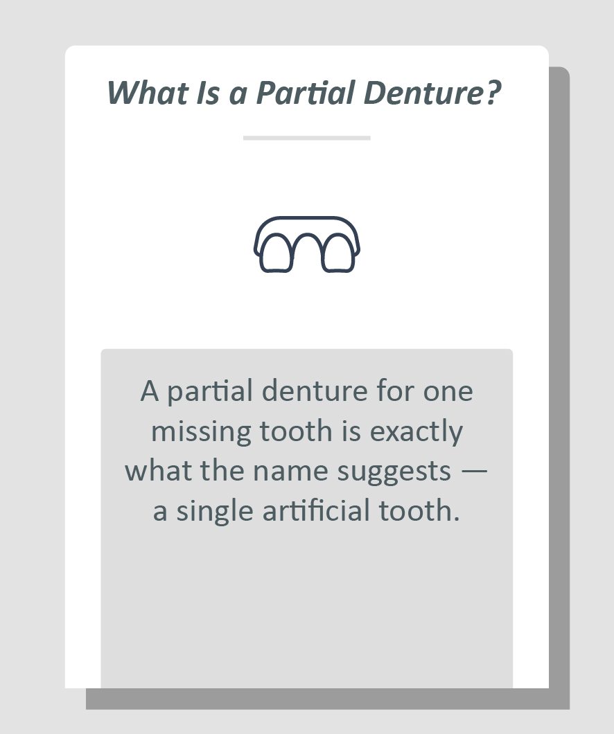 Partial denture for one missing tooth infographic: A partial denture for one missing tooth is exactly what the name suggests — a single artificial tooth.